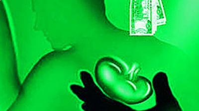 Six of the eight Indians arrested in Colombo were found to have had their kidneys removed in an alleged organ transplant racket in Sri Lanka, the Colombo Crimes Division told the magistrates court. (Representational Image)