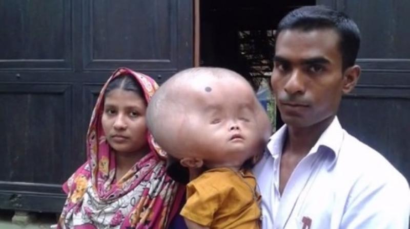 Small Head Big Body Disease 850 Big Head Small Body Photos Stock