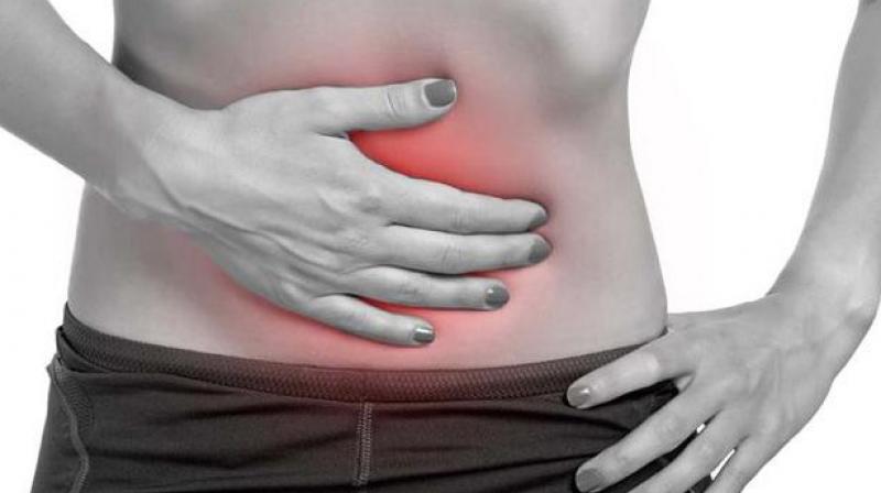 Crohns is a lifelong disease that often strikes people in their early years, leading to decades of suffering, an increased risk of colorectal cancer. (Photo: AFP)