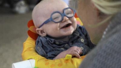 The child suffers from a rare disorder called oculocutaneous albinism. (Photo: Screen grab)