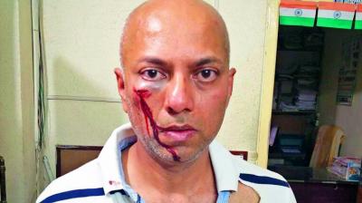 Shashi Preetam, 45, was allegedly attacked by his neighbour Bhanu Prasad on Friday for not returning the money given to him for a project.