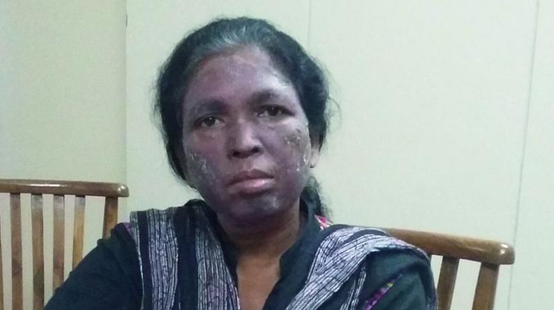 Human rights activist Soni Sori (inset before the attack) 	(Photo: Ishaan Mital)