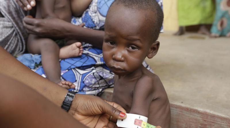 The UNICEF said that nearly half a million children in areas affected by Nigeria's Boko Haram insurgency could suffer from severe acute malnutrition this year. (Photo: AP/Representational) The UNICEF said that nearly half a million children in areas affected by Nigeria's Boko Haram insurgency could suffer from severe acute malnutrition this year. (Photo: AP/Representational)