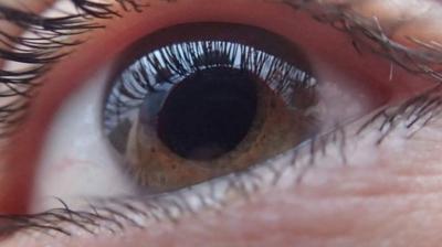 Hepatitis B And C Dangerous For Eyes Hepatitis b eyes,Hepatitis B And C Dangerous For Eyes